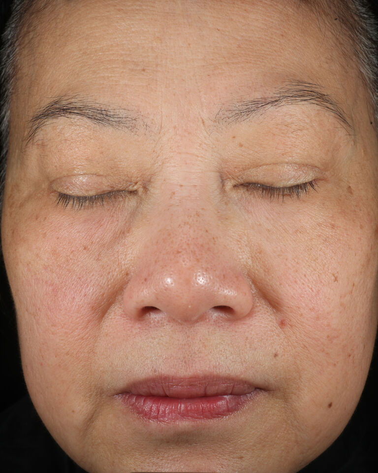 After using Mary Kay Vitamin C+E Serum on brow area